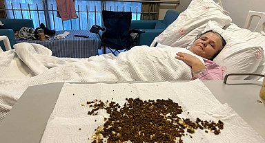 Soma'da 70 Yaşındaki Hastanın Safra Kesesinden 20 Bin Taş Çıktı